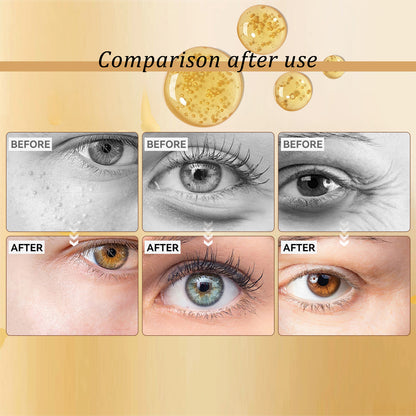 Premium Snail Peptide Eye Cream, Elastic Muscle To Reduce Puffiness And Fine Lines Around The Eye Skin Roller Massage Care Eye Cream